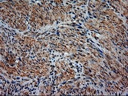 NT3 Mouse anti-Human, Clone: OTI5A2, lyophilized, TrueMAB 100 &mu;g; Unconjugated:Antibodies,