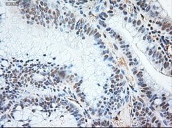 NT3 Mouse anti-Human, Clone: OTI5A2, lyophilized, TrueMAB 100 &mu;g; Unconjugated:Antibodies,