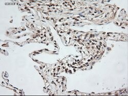 NT3 Mouse anti-Human, Clone: OTI5A2, lyophilized, TrueMAB 100 &mu;g; Unconjugated:Antibodies,
