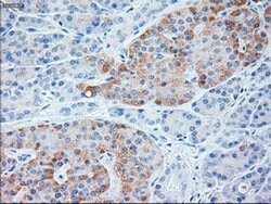 NT3 Mouse anti-Human, Clone: OTI3D4, liquid, TrueMAB 100 &mu;L; Unconjugated:Antibodies,