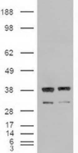 NT3 Mouse anti-Human, Clone: OTI5A2, lyophilized, TrueMAB 100 &mu;g; Unconjugated:Antibodies,
