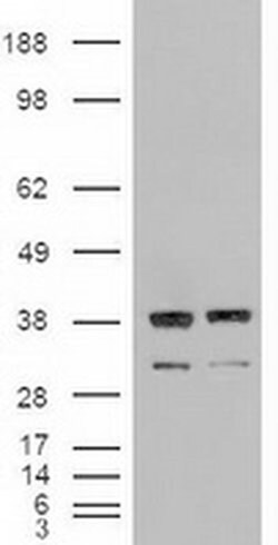 NT3 Mouse anti-Human, Clone: OTI5A2, liquid, TrueMAB 100 &mu;L; Unconjugated:Antibodies,