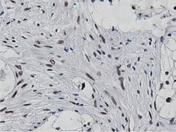 NT5DC1 Monoclonal Antibody (OTI3A6), TrueMAB , OriGene 30 &mu;L; Unconjugated:Antibodies,