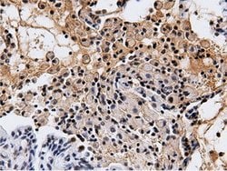 NT5DC1 Mouse anti-Canine, Human, Clone: OTI2H8, lyophilized, TrueMAB 100