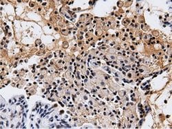 NT5DC1 Monoclonal Antibody (OTI2H8), TrueMAB , OriGene 100 &mu;L; Unconjugated:Antibodies,