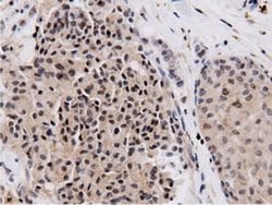 NT5DC1 Monoclonal Antibody (OTI2H8), TrueMAB , OriGene 100 &mu;L; Unconjugated:Antibodies,