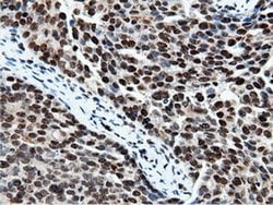 NT5DC1 Monoclonal Antibody (OTI3H2), TrueMAB , OriGene 30 &mu;L; Unconjugated:Antibodies,