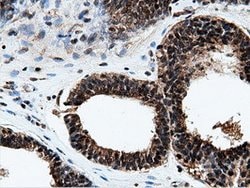 NT5DC1 Mouse anti-Human, Clone: OTI3H2, lyophilized, TrueMAB 100 &mu;g;