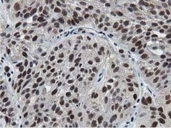 NT5DC1 Monoclonal Antibody (OTI2A1), TrueMAB , OriGene 100 &mu;L; Unconjugated:Antibodies,