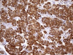 NT5E Monoclonal Antibody (OTI1G2), TrueMAB , OriGene 100 &mu;L; Unconjugated:Antibodies,