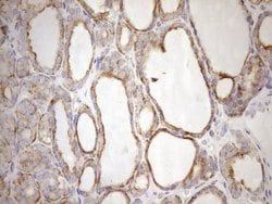 NT5E Monoclonal Antibody (OTI1G2), TrueMAB , OriGene 100 &mu;L; Unconjugated:Antibodies,