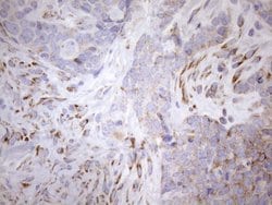 NT5E Monoclonal Antibody (OTI1G2), TrueMAB , OriGene 100 &mu;L; Unconjugated:Antibodies,