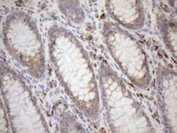 NT5E Monoclonal Antibody (OTI1G2), TrueMAB , OriGene 100 &mu;L; Unconjugated:Antibodies,