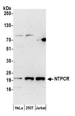 NTPCR Polyclonal Antibody, Bethyl Laboratories 20 &mu;L; Unconjugated:Antibodies,