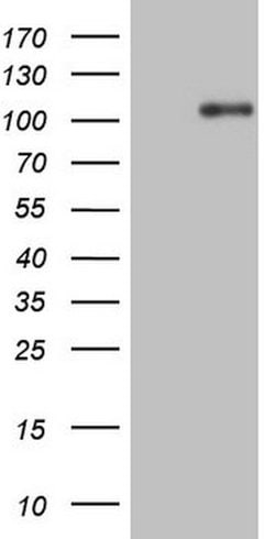 NTRK1 Mouse anti-Human, Clone: OTI5B6, lyophilized, TrueMAB 100 &mu;g;