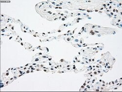 NTRK2 Mouse anti-Human, Clone: OTI2E1, liquid, TrueMAB 30 &mu;L; Unconjugated:Antibodies,