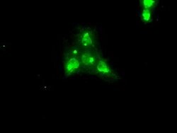 NTRK3 Mouse anti-Human, Clone: OTI4E10, lyophilized, TrueMAB 100 &mu;g;