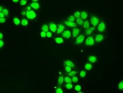 NTRK3 Mouse anti-Human, Clone: OTI4E10, lyophilized, TrueMAB 100 &mu;g;