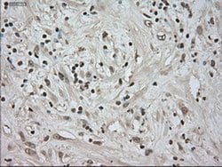 NTRK3 Mouse anti-Human, Clone: OTI2B8, TrueMAB , Origene 30 &mu;L; Unconjugated:Antibodies,