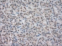 NTRK3 Mouse anti-Human, Clone: OTI2B8, TrueMAB , Origene 30 &mu;L; Unconjugated:Antibodies,