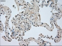 NTRK3 Mouse anti-Human, Clone: OTI4E10, lyophilized, TrueMAB 100 &mu;g;