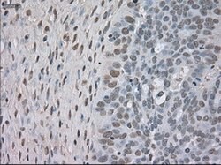 NTRK3 Mouse anti-Human, Clone: OTI4E10, lyophilized, TrueMAB 100 &mu;g;