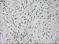 NTRK3 Mouse anti-Human, Clone: OTI4E10, lyophilized, TrueMAB 100 &mu;g;