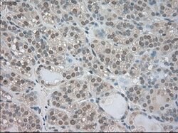 NTRK3 Mouse anti-Human, Clone: OTI4E10, lyophilized, TrueMAB 100 &mu;g;