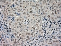 NTRK3 Mouse anti-Human, Clone: OTI4E10, lyophilized, TrueMAB 100 &mu;g;