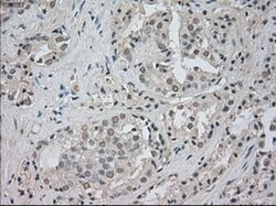 NTRK3 Mouse anti-Human, Clone: OTI4E10, lyophilized, TrueMAB 100 &mu;g;
