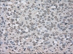 NTRK3 Mouse anti-Human, Clone: OTI4E10, lyophilized, TrueMAB 100 &mu;g;
