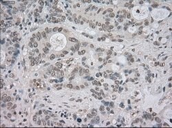 NTRK3 Mouse anti-Human, Clone: OTI4E10, lyophilized, TrueMAB 100 &mu;g;