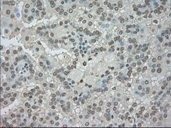 NTRK3 Mouse anti-Human, Clone: OTI4E10, lyophilized, TrueMAB 100 &mu;g;