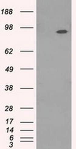 NTRK3 Mouse anti-Human, Clone: OTI2B8, TrueMAB , Origene 30 &mu;L; Unconjugated:Antibodies,