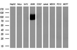 NTRK3 Mouse anti-Human, Clone: OTI2B8, TrueMAB , Origene 30 &mu;L; Unconjugated:Antibodies,