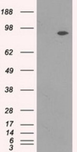 NTRK3 Mouse anti-Human, Clone: OTI4E10, lyophilized, TrueMAB 100 &mu;g;