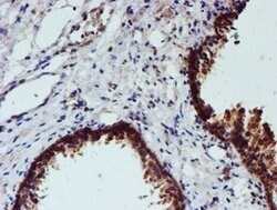 NUBPL Mouse anti-Human, Clone: OTI5D5, lyophilized, TrueMAB 100 &mu;g;