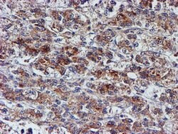NUBPL Mouse anti-Human, Clone: OTI5D5, lyophilized, TrueMAB 100 &mu;g;
