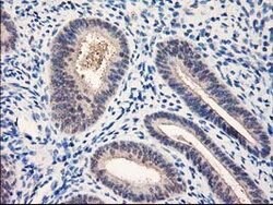NUBPL Mouse anti-Human, Clone: OTI3D11, lyophilized, TrueMAB 100 &mu;g;