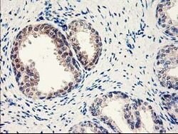 NUBPL Mouse anti-Human, Clone: OTI3D11, lyophilized, TrueMAB 100 &mu;g;