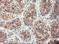NUBPL Mouse anti-Human, Clone: OTI3D11, lyophilized, TrueMAB 100 &mu;g;