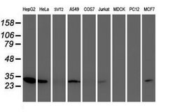 NUBPL Mouse anti-Human, Clone: OTI5F8, lyophilized, TrueMAB 100 &mu;g;