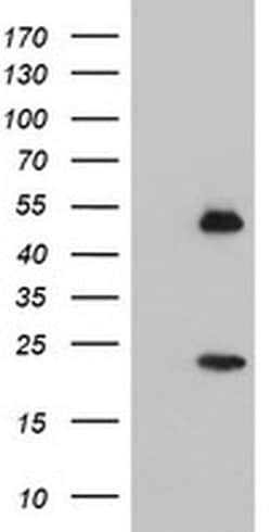 NUCB1 Monoclonal Antibody (OTI2A5), TrueMAB , OriGene 100 &mu;L; Unconjugated:Antibodies,