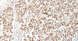 NUCKS Rabbit anti-Human, Polyclonal, Bethyl Laboratories 10 &mu;L; Unconjugated:Antibodies,