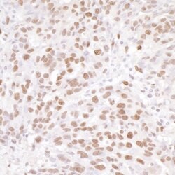 NUCKS Rabbit anti-Human, Polyclonal, Bethyl Laboratories 100 &mu;l; Unlabeled:Antibodies,