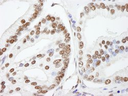 NUCKS Polyclonal Antibody, Bethyl Laboratories:Antibodies:Primary Antibodies