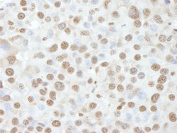 NUCKS Polyclonal Antibody, Bethyl Laboratories 10 &mu;L; Unconjugated:Antibodies,