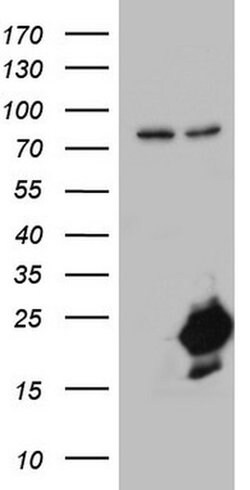 NUDT10 Monoclonal Antibody (OTI2D9), TrueMAB , OriGene 30 &mu;L; Unconjugated:Antibodies,