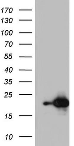 NUDT10 Mouse anti-Human, Clone: OTI2G8, lyophilized, TrueMAB 100 &mu;g;