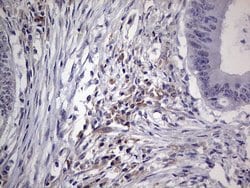 NUDT12 Monoclonal Antibody (OTI5B6), TrueMAB , OriGene:Antibodies:Primary